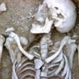 Stress Along the Medieval Anglo-Scottish Border? Skeletal Indicators of Conflict-Zone Health The medieval British populations living along the Anglo-Scottish border from the 10th through the 16th century were hypothesised to have significantly higher mortality and morbidity rates than contemporary populations living in other regions of Britain that were not exposed to chronic border warfare.