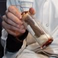Under the authority of the Association des Amis du Vieux Chinon and the Archbishop of Tours (curator of the remains), a scientiﬁc analysis was recently performed on the so-called ‘relics of Joan of Arc’, which reside in Chinon (in central France).