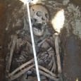 The Poisoned Arrows of Amor: cases of syphilis from 16th-century Iceland The number of syphilis cases at the Skriðuklaustur monastery is unexpectedly high, as nine individuals with the disease have been identified in a skeletal assemblage totalling only 198 skeletons. At least two of the cases bear the signs of congenital syphilis. The youngest individual was just an adolescent at death but still showed severe symptoms of congenital syphilis that had developed to the tertiary stage.