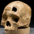 Cranial Trauma and Treatment: A Case Study from the Medieval Cemetery of St. Mary Spital, London The individual under examination was context number 19893, from a burial pit situated to the southwest of an early 14th century charnel house.