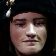 The Face of Richard III revealed The calm and apparently thoughtful face is in stark contrast to the many portrayals of Richard III, showing contorted facial and bodily features, that were created for political reasons following his death.