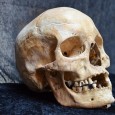 Scientific research reveals insights into medieval leprosy Why was there a sudden drop in the incidence of leprosy at the end of the Middle Ages?