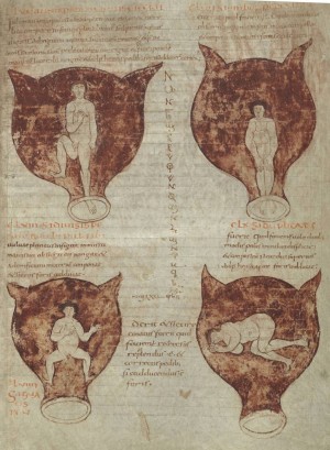 From Soranus'work "Gynaikeia" illustrating  various presentations of the foetus. Manuscript  of 19th c. Royal Library, Brussels