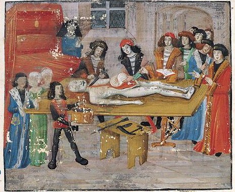 Autopsy of a noble mother, by Guy of Chauliac, late 15th century France