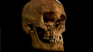Richard III skull