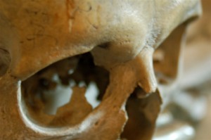 medieval skull - photo by Todd Huffman / Flickr