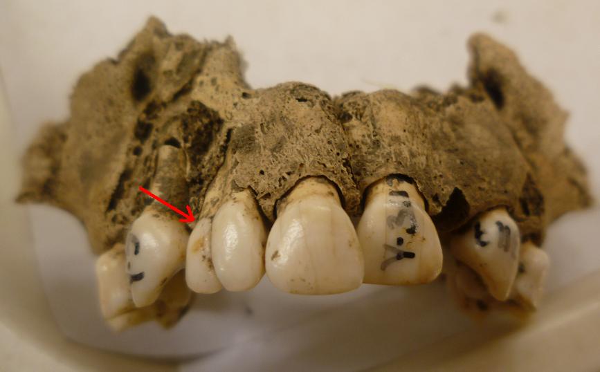 medieval teeth