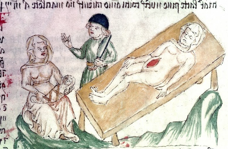 Caesarean Section