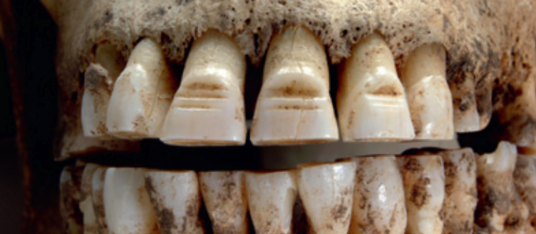 viking filed teeth