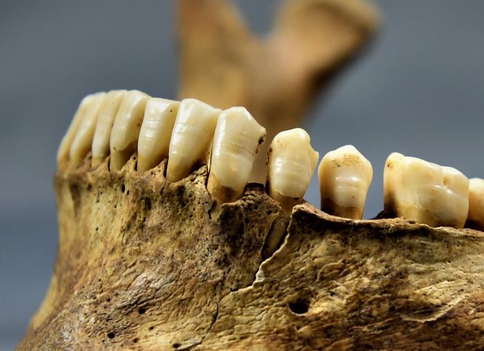 Was Zähne über die Gesundheit frühmittelalterlicher Kinder verraten können
