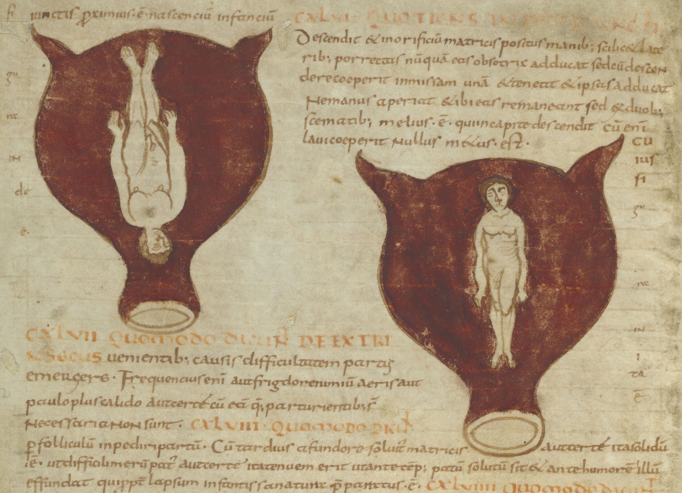 The Unusual Status of the Unborn Child in Medieval Valais - Medievalists.net